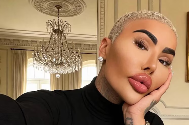 Murió Jordan James Parke, el influencer conocido como el 'Rey de los labios' que se quería parecer a Kim Kardashian
